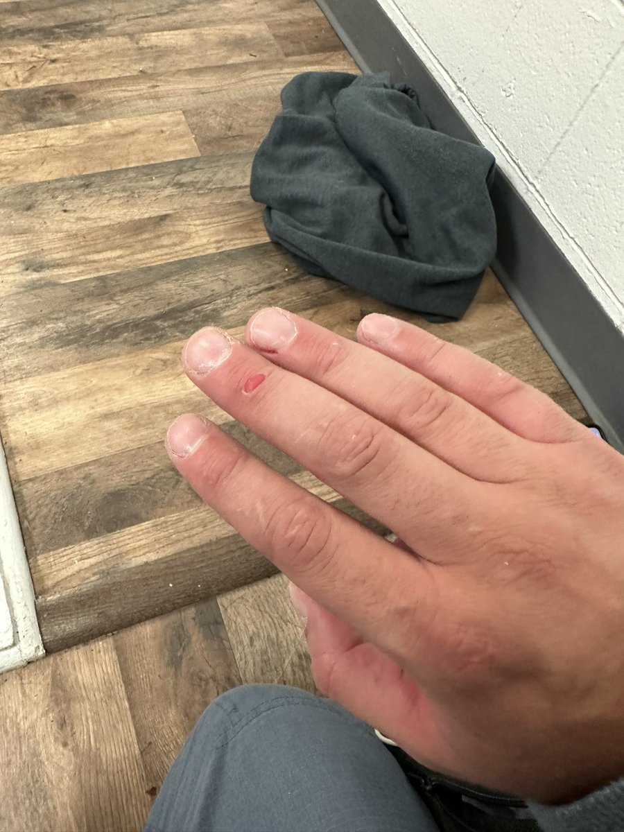 Bjj fingers