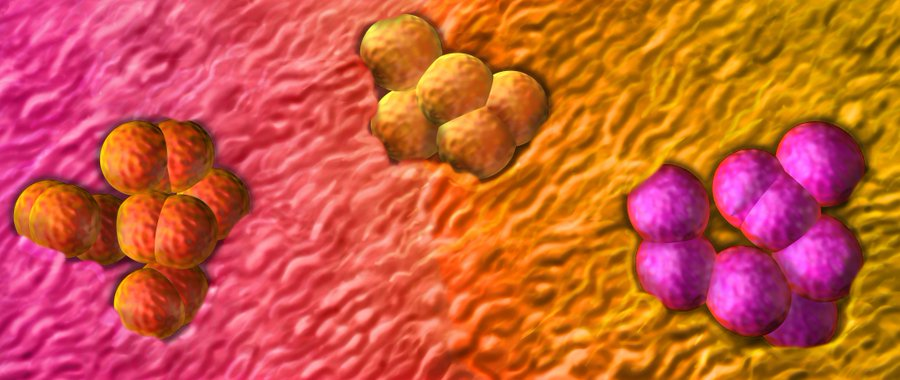 TaliLev123's tweet photo. 🌟Highlighting for #AACRtii23: Distinct Mechanisms of #MismatchRepair Deficiency Delineate Two Modes of Response to PD-1 #Immunotherapy in #EndometrialCarcinoma, published in @CD_AACR by @ScienceChow et al. https://t.co/WRWZKq9VFV @YaleMed https://t.co/WDSdgVbJzH