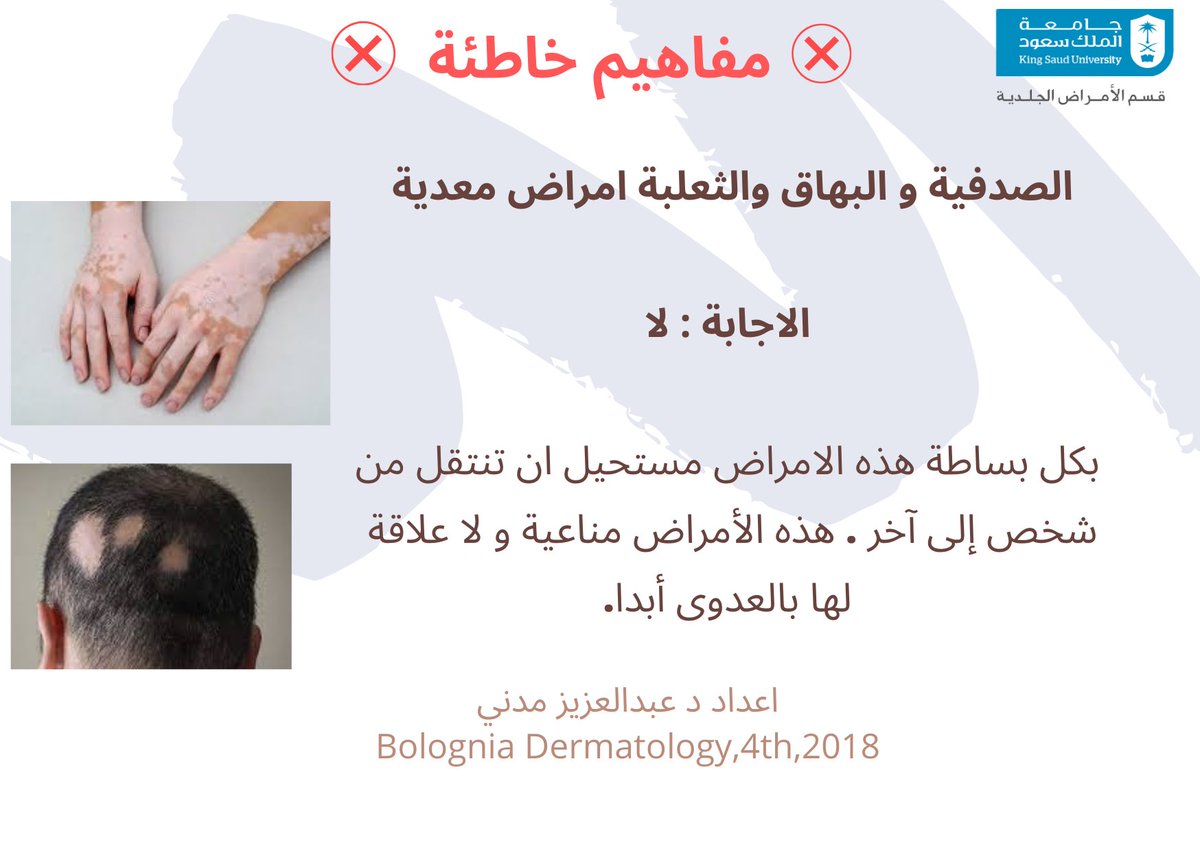 DERMA_KSU's tweet photo. نقدم لك معلومة على الصباح من طبيب الامراض الجلدية. #الامراض_الجلدية #الصدفية #البهاق #الثعلبة #عدوى #الامراض_المعدية #مفاهيم_خاطئة #هل_تعلم #معلومة_اليوم https://t.co/QVMDwZO2c7
