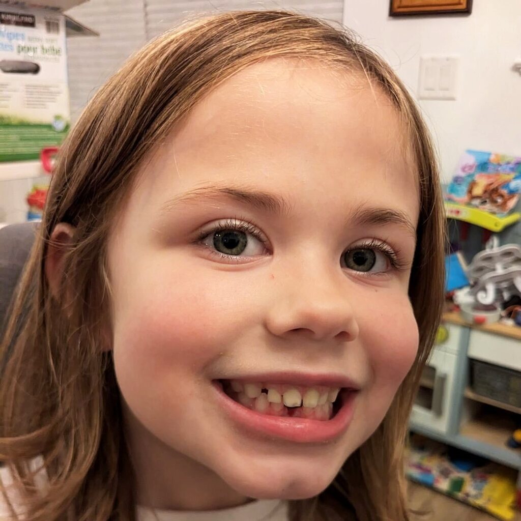 lyteforce's tweet photo. What’s the going rate for the tooth fairy these days? #Babyforce lost her first. https://t.co/TKF7nfRDrQ