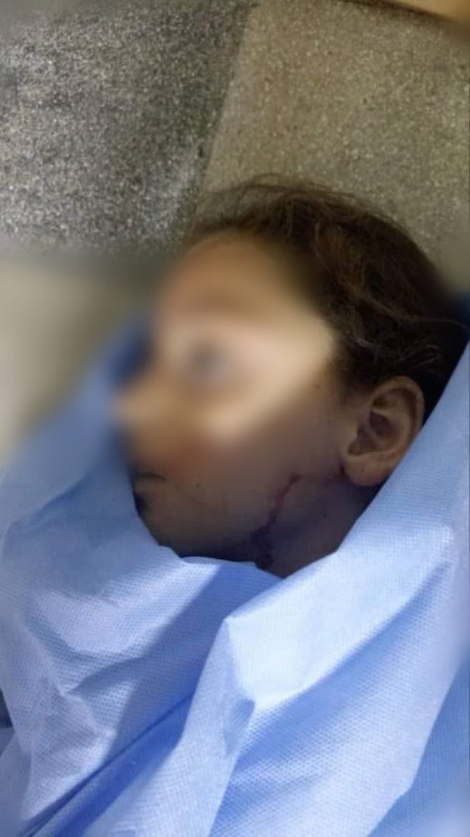 This is a Syrian girl named "Laila" who was killed today by Assad's forces and Russia in the countryside of Idlib, Syria. Russia is still committing the most horrific massacres against Syrian and Ukrainian children. Russia is a terrorist state.