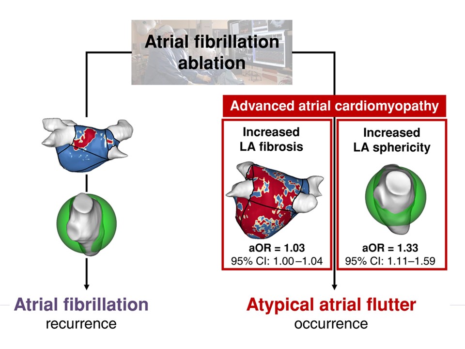 European Society of Cardiology Journals (@esc_journals) on Twitter photo Advanced atrial cardiomyopathy assessed by #CMR is associated with arrhythmia recurrence after #AF ablation 👉 bit.ly/3MamHzF
<a href="/EuropaceEiC/">Europace Editor-in-Chief</a> <a href="/GiulioConte9/">Giulio Conte</a> <a href="/Dominik_Linz/">Dominik Linz</a> <a href="/FraSantoroMD/">Francesco Santoro, MD, PhD</a> <a href="/AndyZhangMD/">Xiaodong Zhang (Andy), MD, PhD, FHRS, FACC</a> <a href="/marcovitoloMD/">Marco Vitolo Ⓜ️</a> #Europace #arrhythmias #AF #CMR Advanced atrial cardiomyopathy assessed by #CMR is associated with arrhythmia recurrence after #AF ablation 👉 bit.ly/3MamHzF
<a href="/EuropaceEiC/">Europace Editor-in-Chief</a> <a href="/GiulioConte9/">Giulio Conte</a> <a href="/Dominik_Linz/">Dominik Linz</a> <a href="/FraSantoroMD/">Francesco Santoro, MD, PhD</a> <a href="/AndyZhangMD/">Xiaodong Zhang (Andy), MD, PhD, FHRS, FACC</a> <a href="/marcovitoloMD/">Marco Vitolo Ⓜ️</a> #Europace #arrhythmias #AF #CMR