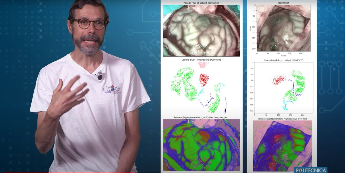🗣️Sobre imágenes hiperespectrales nos habla Eduardo Juárez, profesor #UPM e investigador de <a href="/CITSEM/">CITSEM</a>, en esta segunda entrevista de <a href="/NEUROTEC_UPM/">NEUROTEC</a> Interview Series. ¡No te lo pierdas!
📺youtube.com/watch?v=14n6Rf…
#somosUPM