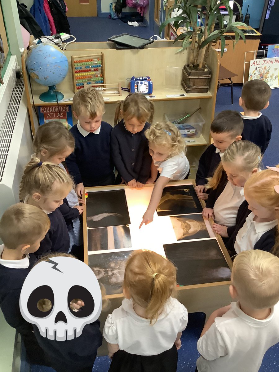 BandBschool's tweet photo. Team Esk are examining pictures of x-rays as part of our topic. We read Funny Bones and talked about the bones we could see in the book and compared them to our x-rays #BandBeyfs  #BandBscience https://t.co/CBkY5ni2yR