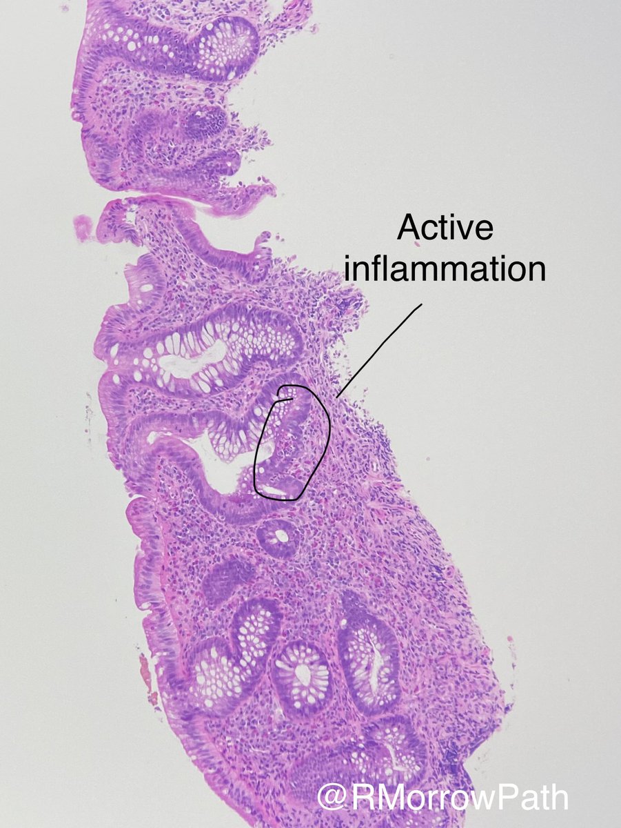 Dr Rebecca Morrow (her/she) tweet media
