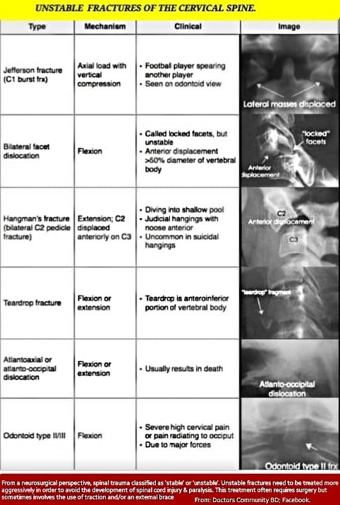 Odontoid and hangman fracture