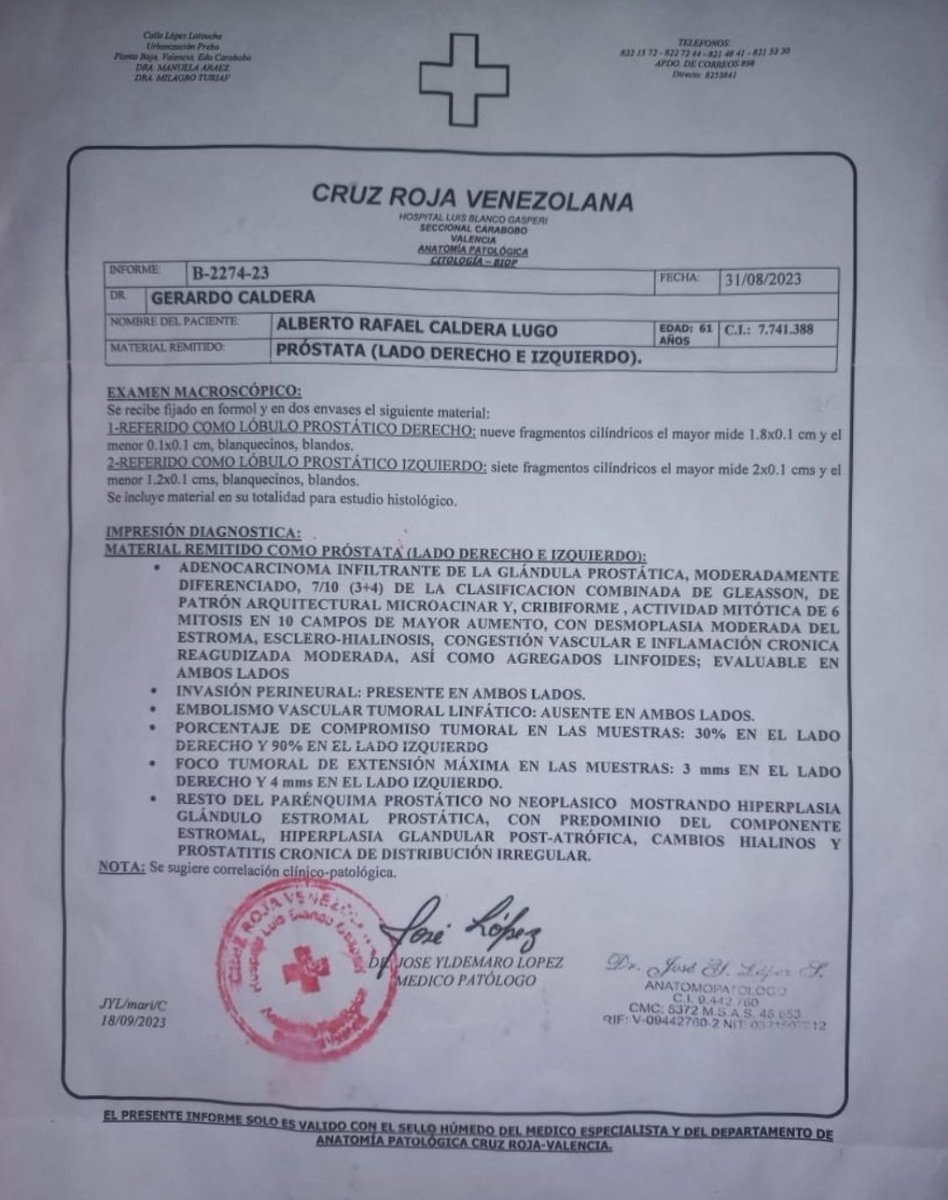 Nelsonpvzla1's tweet photo. 📢 Un dólar, un repost o un like será una GRAN AYUDA

Alberto Caldera, un vecino de mi comunidad al que aprecio, es uno de los miles de Venezolanos que padece Cancer de Próstata y sufre por la precariedad del sistema de salud y NO cuenta con los recursos para tratar su enfermedad https://t.co/nlwwAbuCvn