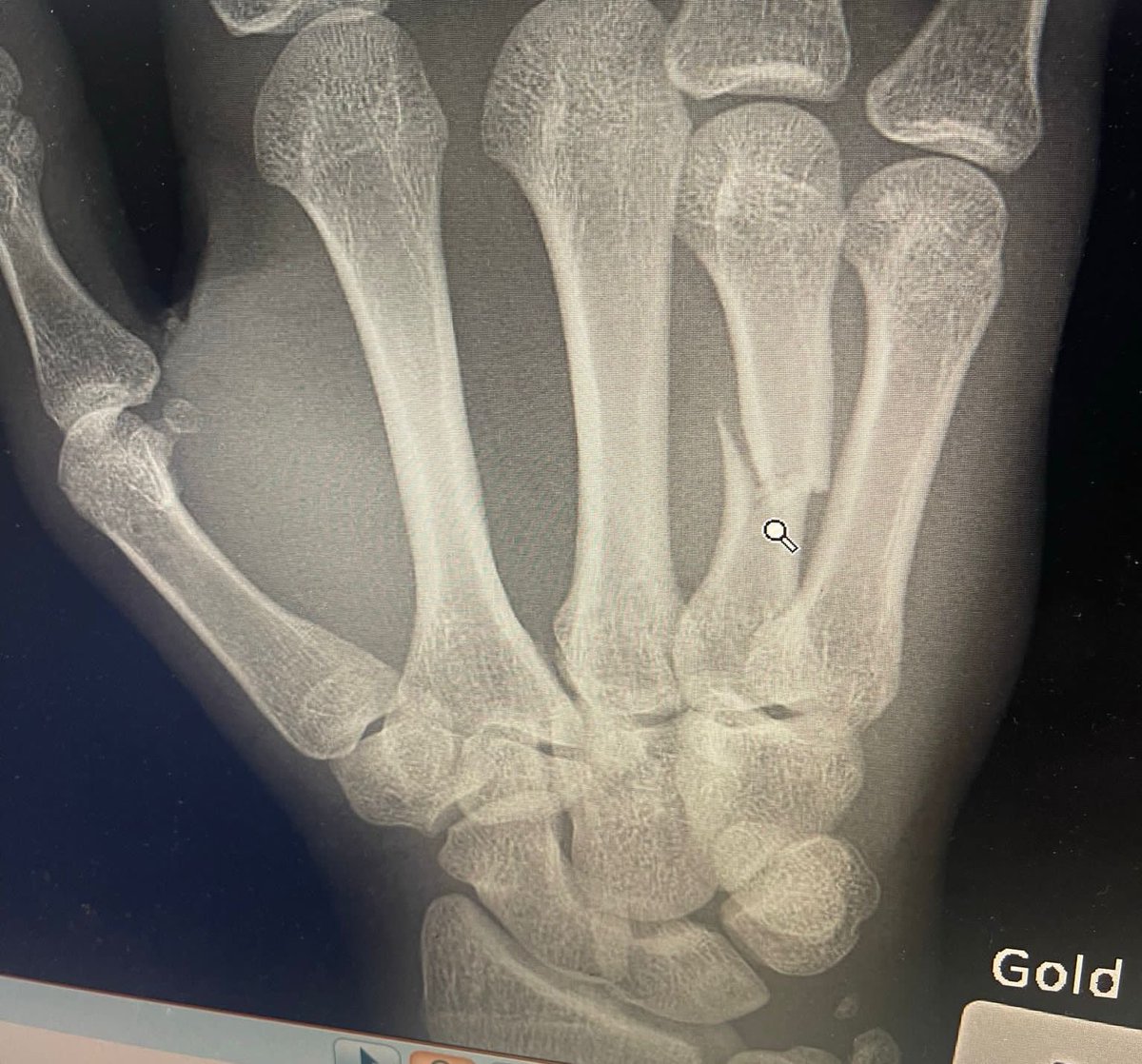 Luke Riley tweet media