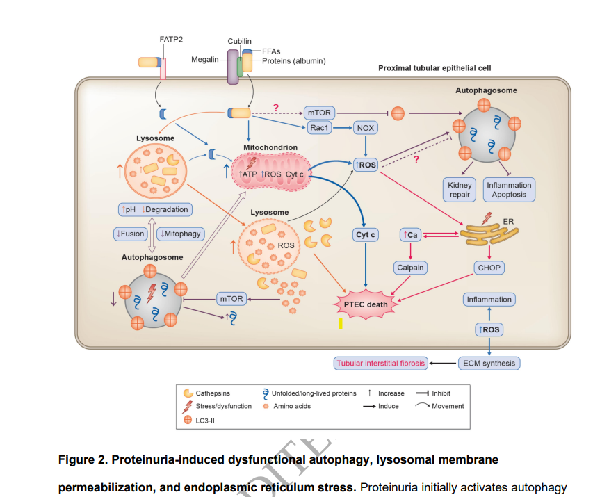 NDTsocial's tweet photo. Tubular toxicity of proteinuria &amp; progression of CKD
https://t.co/ExeDeiar2V
This Review summarizes toxic proteins reported in proteinuria &amp; the current understanding of molecular mechanisms of toxicity of proteins on proximal tubular epithelial cells leading to CKD progression https://t.co/SIvkIhjEiF