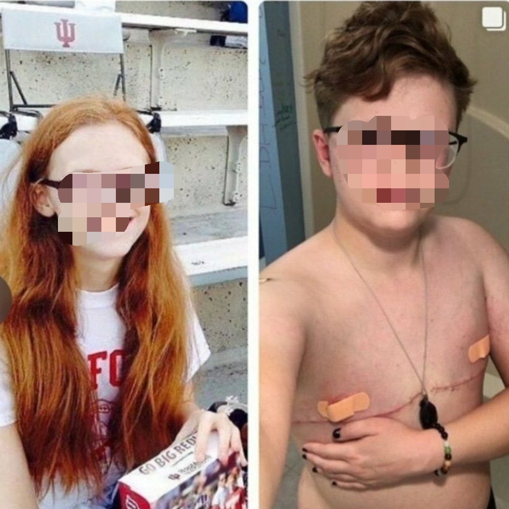 Sondeo Tuitero 

Está de acuerdo con la operación de cambio de sexo en niños?

NO: 🔄
SÍ: ♥️

#ConLosNiñosNoTeMetas