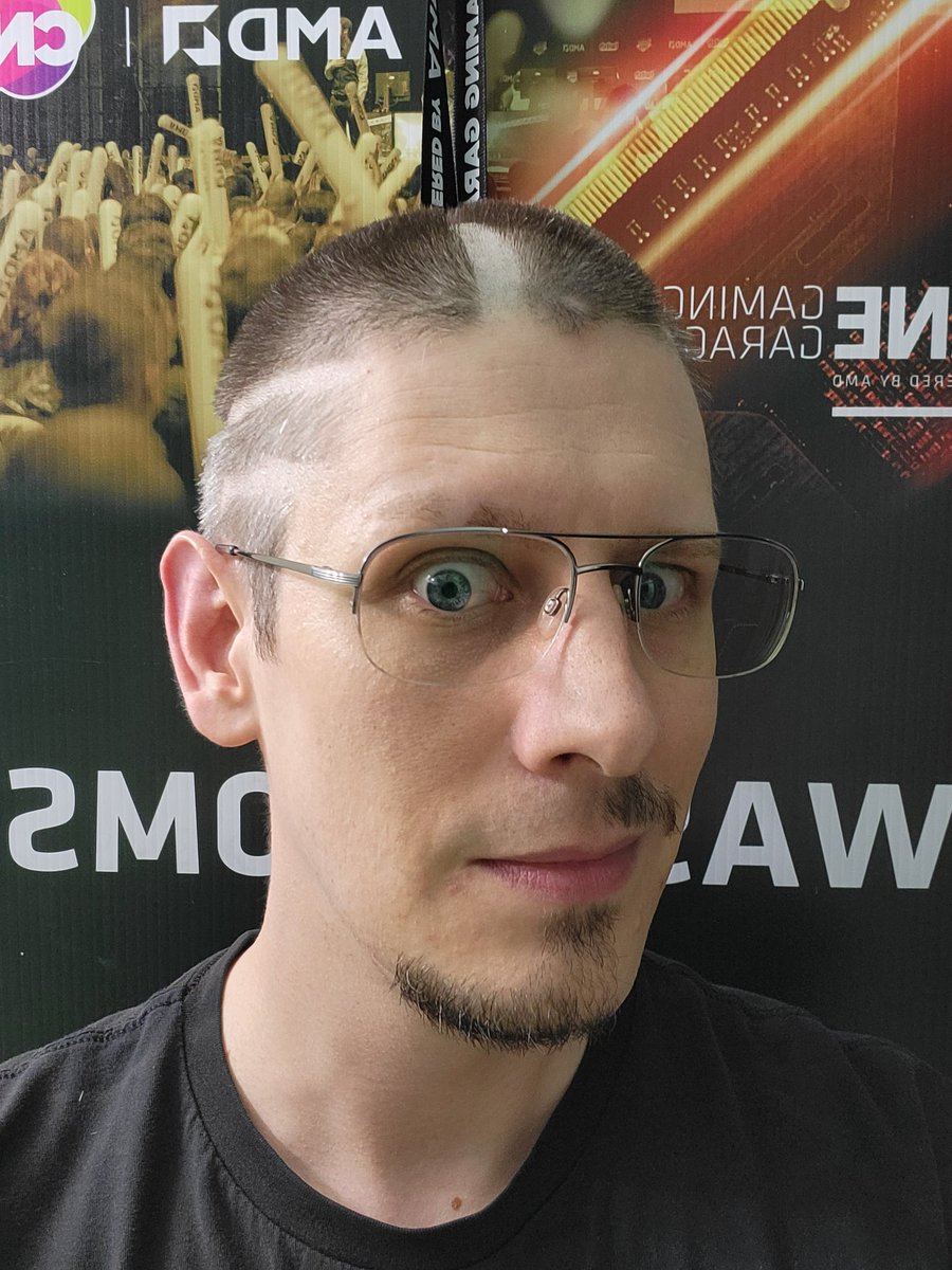 TefensTech's tweet image. I gave myself a whacky hair cut to join you @UFDTech in spirit during the #cannonballforthecure raising funds for #syngap1 @cureSYNGAP1