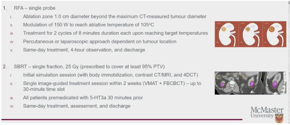 urotoday's tweet photo. Final results from a prospective randomized pilot trial of SBRT vs. radiofrequency ablation for the management of small renal masses #RADSTER. Presentation by Anand Swaminath, MD @HamHealthSci. #ASTRO23 written coverage by @RKSayyid @UofT > https://t.co/EeSrcWyWi1 @ASTRO_org https://t.co/ORRVLfsLTV