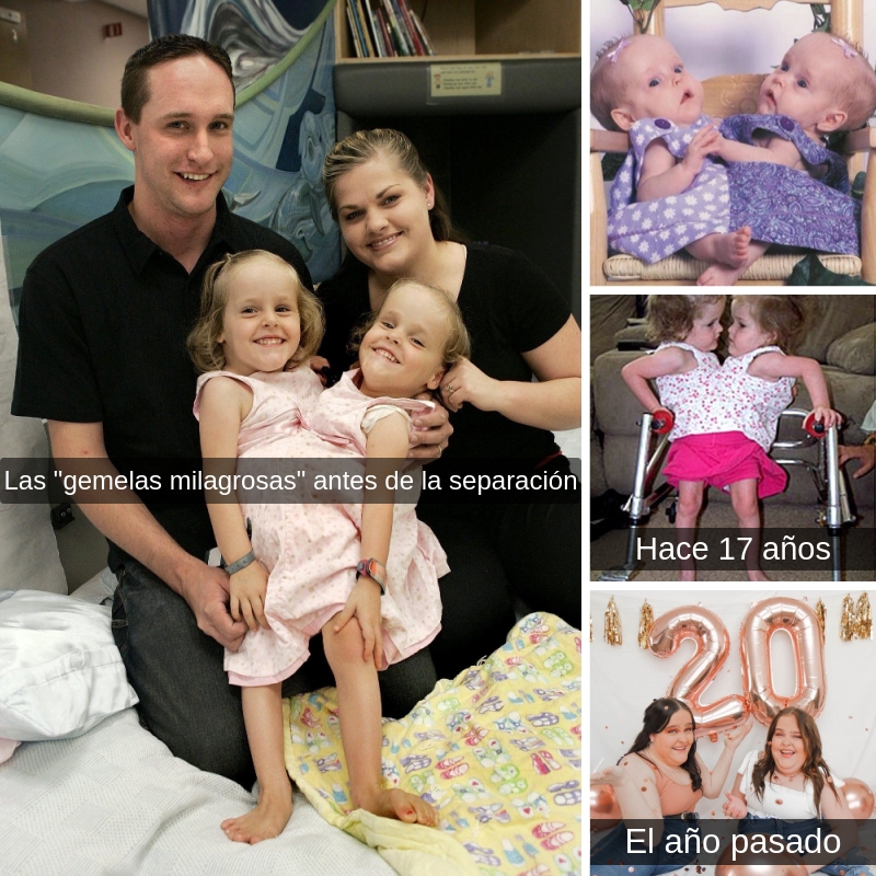 jaco_wacko's tweet photo. Tras 16 años viviendo separadas, Kendra y Maliyah nos inspiran a continuar superándose