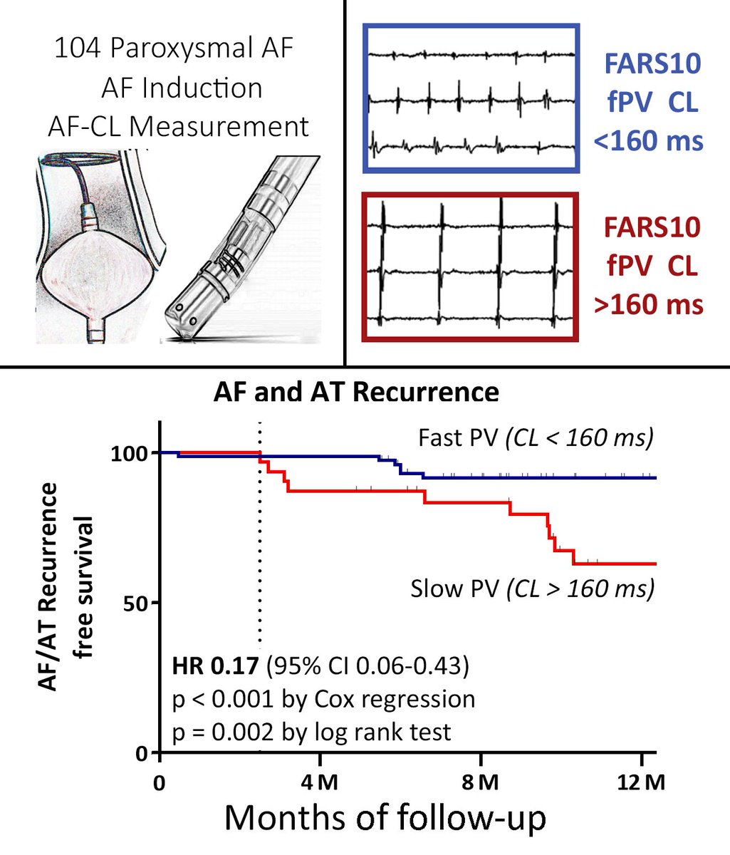 MBergonti's tweet image. Do you want to know if #PVI will be enough in your AF patient? 

Just look into the pulmonary veins 👀 

link.springer.com/article/10.100…

#EPeeps #CardioTwitter