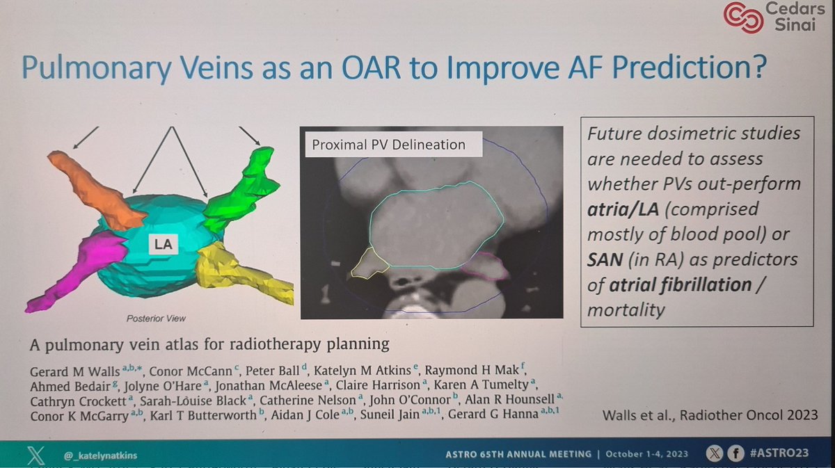 Gerard Walls (@gwalls89) on Twitter photo Masterclass on minimising cardiotoxicity risk using cardiac substructure contours, baseline CV risk & sensible endpoints by <a href="/_katelynatkins/">Katelyn Atkins, MD, PHD</a> at #ASTRO2023
Much progress in recent years but a long way still to go in lung cancer
<a href="/Dr_RayMak/">Ray Mak, MD</a> <a href="/mctjong/">Michael Tjong</a>
<a href="/carmenbergom/">Carmen Bergom MD PhD</a> <a href="/K_Butterworth/">Karl Butterworth</a> Masterclass on minimising cardiotoxicity risk using cardiac substructure contours, baseline CV risk & sensible endpoints by <a href="/_katelynatkins/">Katelyn Atkins, MD, PHD</a> at #ASTRO2023
Much progress in recent years but a long way still to go in lung cancer
<a href="/Dr_RayMak/">Ray Mak, MD</a> <a href="/mctjong/">Michael Tjong</a>
<a href="/carmenbergom/">Carmen Bergom MD PhD</a> <a href="/K_Butterworth/">Karl Butterworth</a>