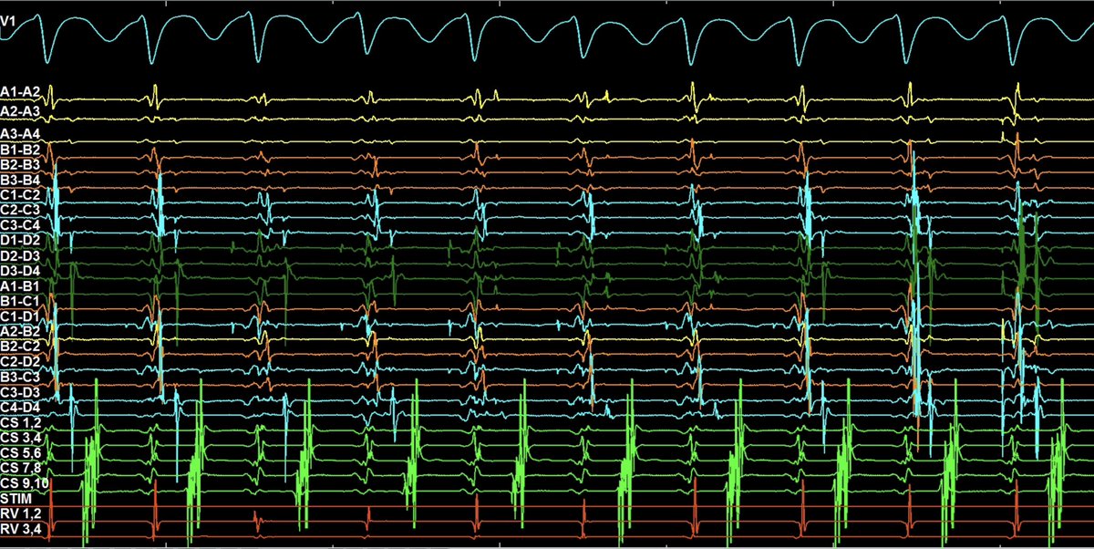 Sebastian Weyand tweet media