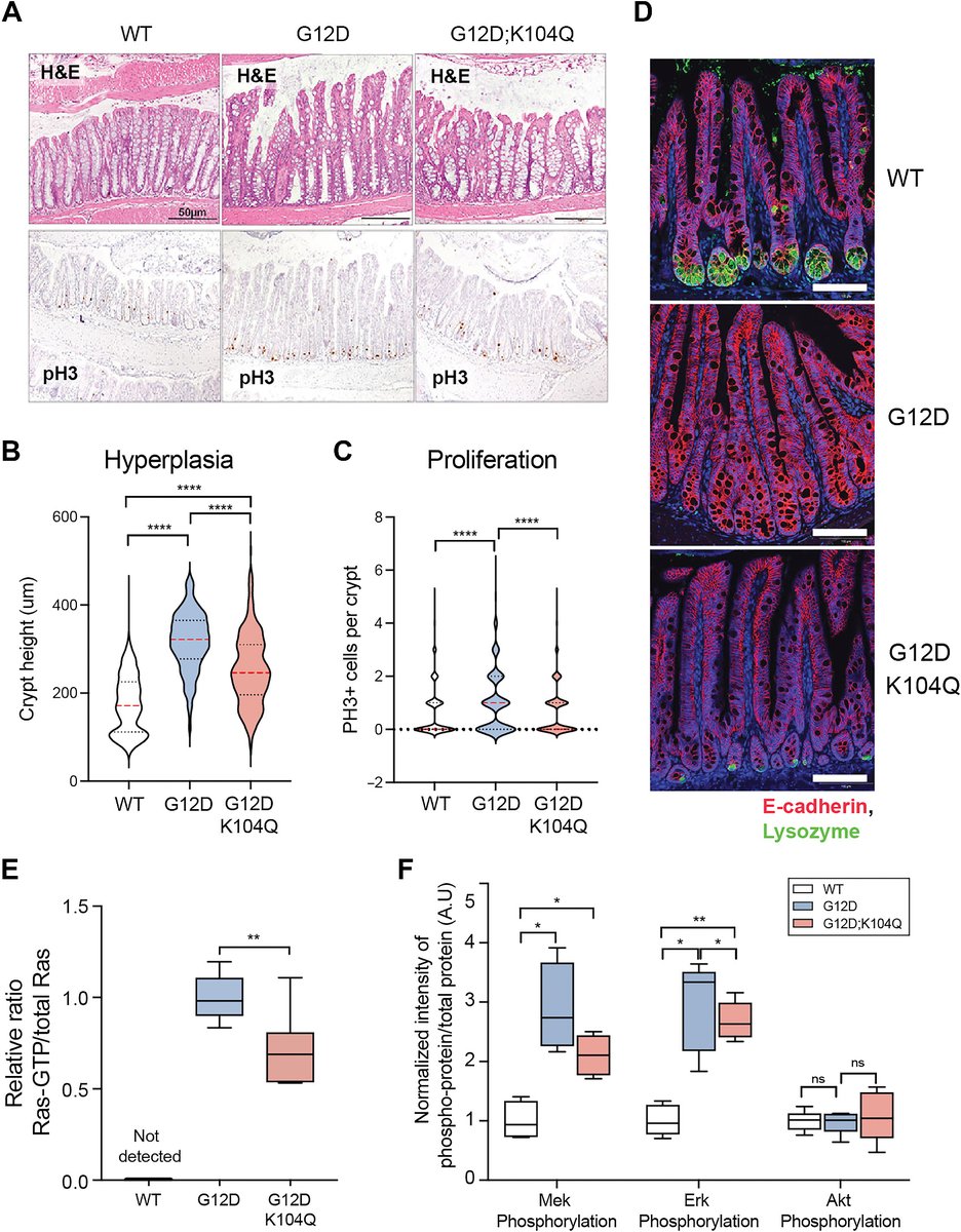 Cancer Research (@cr_aacr) on Twitter photo From the newest issue— Allosteric Regulation of Switch-II Domain Controls #KRAS Oncogenicity, by <a href="/simanshu/">Simanshu Dhirendra</a>, @FredNatLab, <a href="/KevinHaigisLab/">Kevin Haigis Lab</a> et al.
bit.ly/3tgS8kZ
<a href="/DanaFarberNews/">Dana-Farber News</a> From the newest issue— Allosteric Regulation of Switch-II Domain Controls #KRAS Oncogenicity, by <a href="/simanshu/">Simanshu Dhirendra</a>, @FredNatLab, <a href="/KevinHaigisLab/">Kevin Haigis Lab</a> et al.
bit.ly/3tgS8kZ
<a href="/DanaFarberNews/">Dana-Farber News</a>