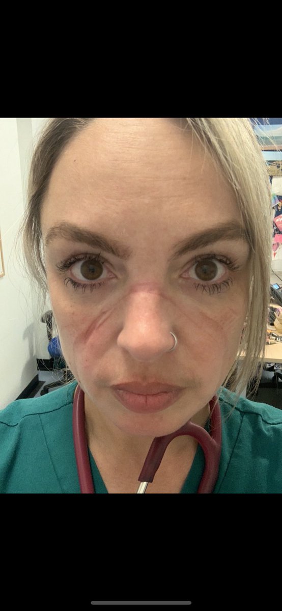 Just watched #Partygate and well…. It’s a lot. Remembering not even being able to have lunch with my colleagues whilst we were going through it at work. The PPE worries. The FaceTime goodbyes. Just all of it. Whilst they partied.