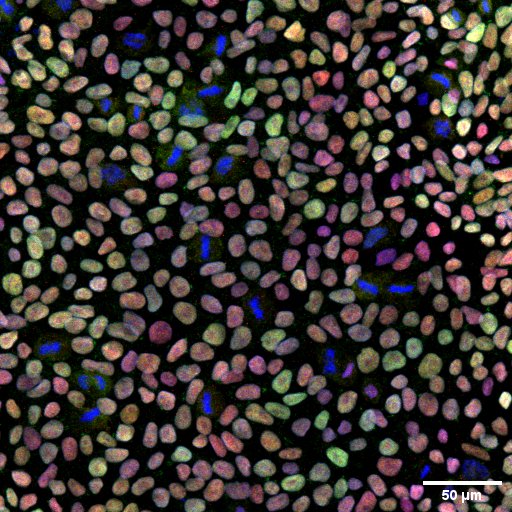 Happy Oct4 pluripotency day from the amazing stem cell scientist in the Maher lab. Thanks @sriniiirao @ARomeroMorales Deb Das, Gina Shim, and Sam Myung for your expertise.