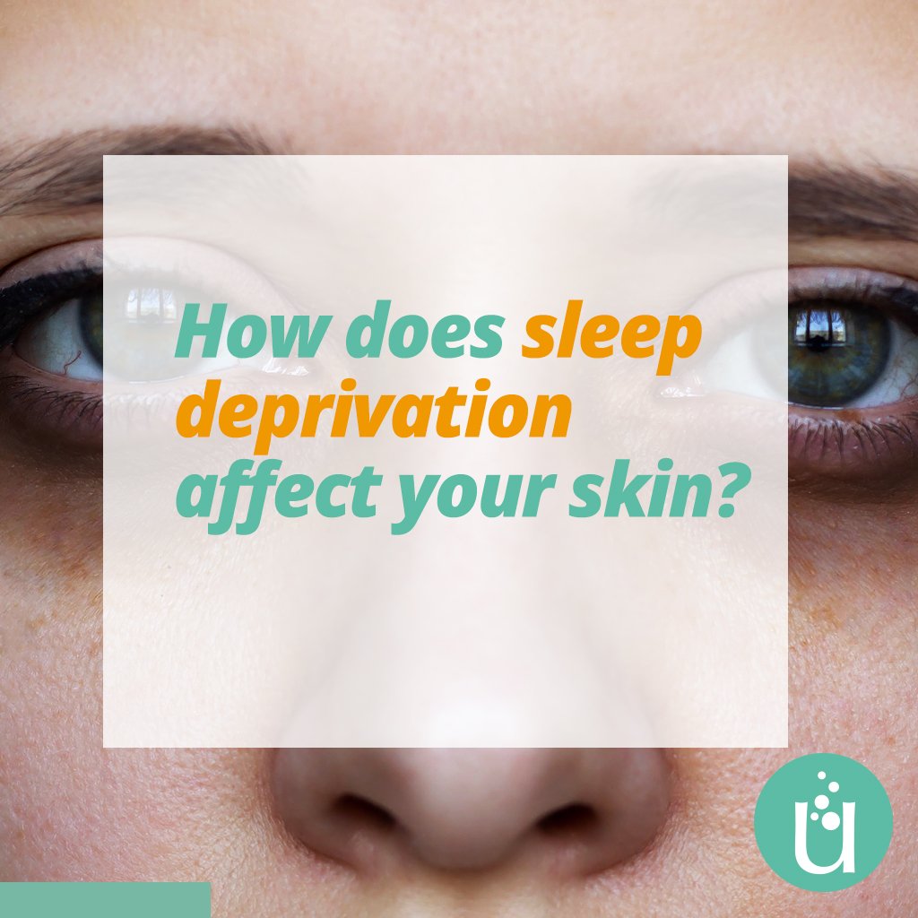 KureLab's tweet photo. Beyond just red eyes, saggy eyelids, and dark circles, sleep deprivation has been linked to paler skin, increased wrinkles and fine lines, and droopier corners of the mouth. Sleep disorders can be serious illnesses that shouldn't be underestimated.
#SkinCare #KureLab #Dermatology https://t.co/VDVR63r6zv