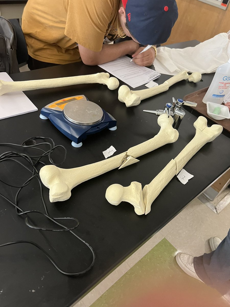 MrsTLLarkin's tweet image. .@MassLearning #PLTWMA HBS fracture repairs… #whoneedsatextbookanymore #learnthroughdoing collaboration, hands on and modeling @UxbHSPrincipal #spartanpride