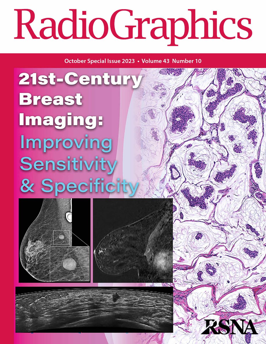 The @RadioGraphics Breast Imaging Monograph is now available! Check out the issue here. bit.ly/NewRadG #RGphx #RadCME #RadRes @RadG_Editor