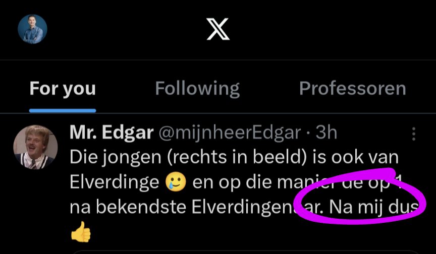 mhousen3's tweet photo. @mijnheerEdgar Bespeuren we hier een enige onzekerheid?
#blankepit https://t.co/bk4u2UhXma