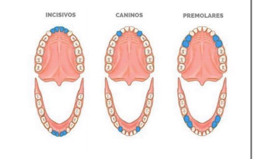 paz837's tweet photo. #Antofagasta Hola!Soy estudiante de odontología y busco pacientes para tratamientos de conducto (endodoncia)Jueves a las 15:00hrs evaluación
(Solo los dientes de la imagen)

Dolor severo a cambios de temperatura
Dolor a la masticación
Caries extensa
fractura dental
 +56993349158 https://t.co/sYH3F6gNwL
