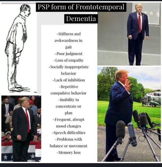 DeirdreJones54's tweet image. #TheDonOfDementia  #DutyToWarn