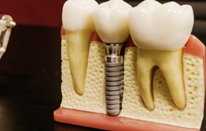 AlotHealth's tweet photo. A beautiful, healthy smile is not only a source of confidence but also essential for overall well-being. 

https://t.co/MIgY6SQBbk https://t.co/FrwsGyvERk