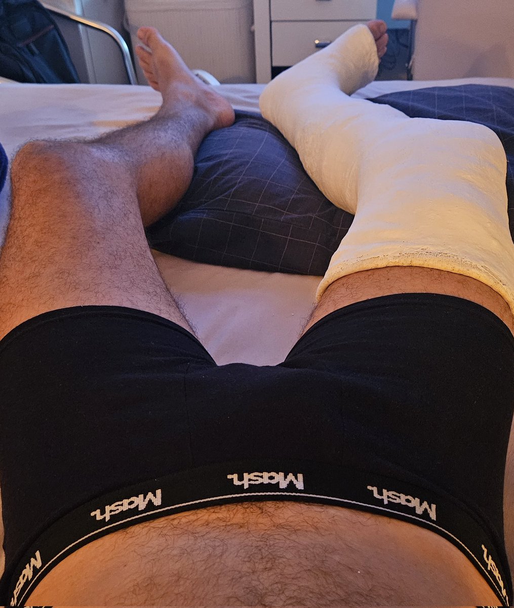 caster_well's tweet photo. New LLC
#castfetish #plastercast #llc #llccast #longlegcast #peengessado #pernaengessada #engessado #feet #malefeet #gayfeet https://t.co/NiMyfWUhEF