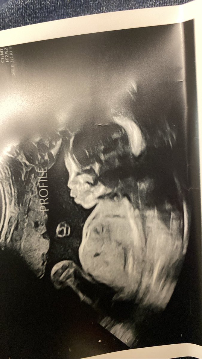 classieee__'s tweet image. I love you🥺💕