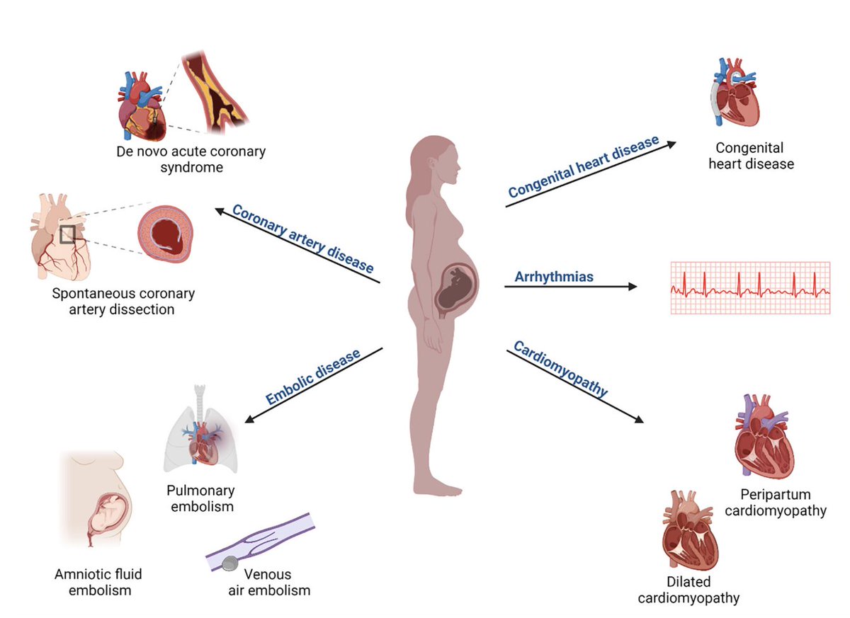 Cardiogenic shock in pregnancy: a review. 

obgyn.onlinelibrary.wiley.com/doi/epdf/10.11…