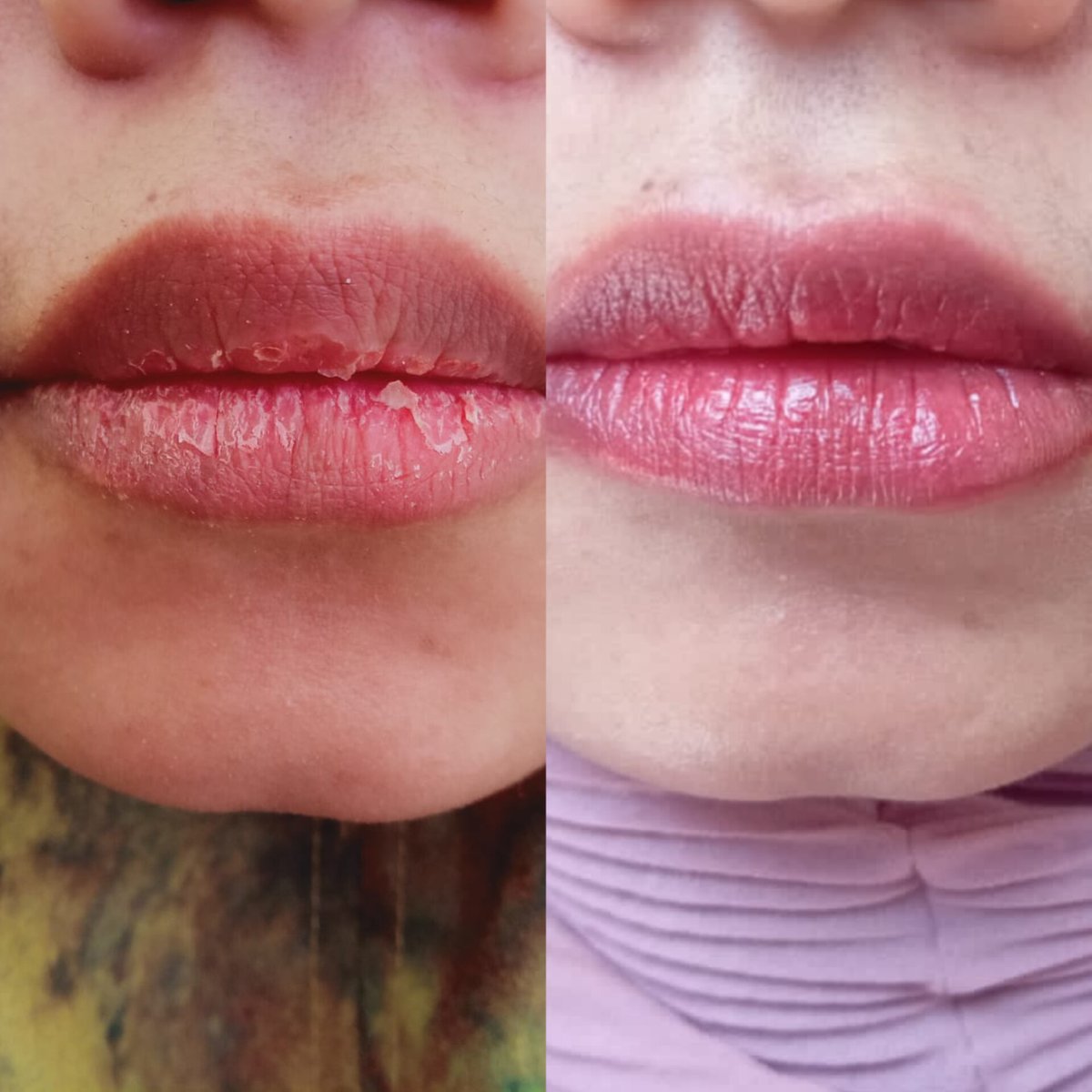 inggikologi's tweet photo. Nyari lip tint yg bikin muka on trus bisa ngatasin bibir kering???? Nih aku nemu
This is my color character
#ItsMyColorCharacter #MizzuxSasa #MizzuCosmetics #BeautifulYouth https://t.co/jvMA4QjI73