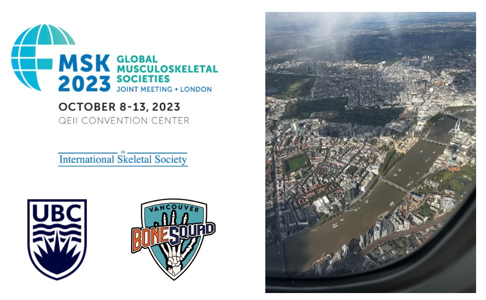 The Vancouver Bone Squad has started arriving in London, England in droves for the #ISS2023 from October 8-13, 2023. 
@intskeletal 
Good Luck to all our fellows, alumni, honorary members and staff presenting at the meeting! See you all at the Bone Squad reception October 10th!