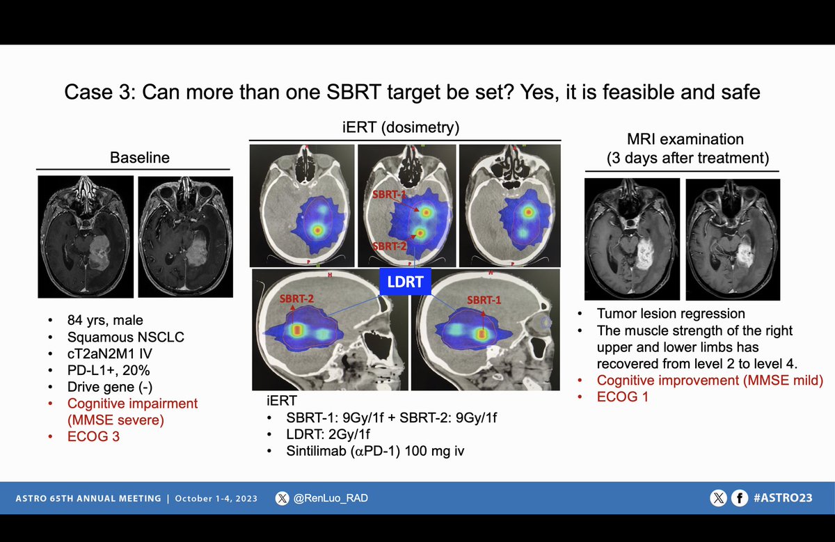 RenLuo_RAD's tweet photo. Thank the nice moderators @HMcGeeMDPhD and Arta Monjazeb at #ASTRO2023 on innate immunity and TIME! And nice discussion with @ARajkumarMD and Tissana
Prasartseree about Lattice radiation https://t.co/FOdoKcJD80