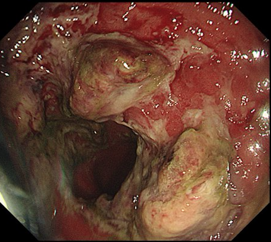 Sociedad Española de Patología Digestiva (SEPD) tweet media