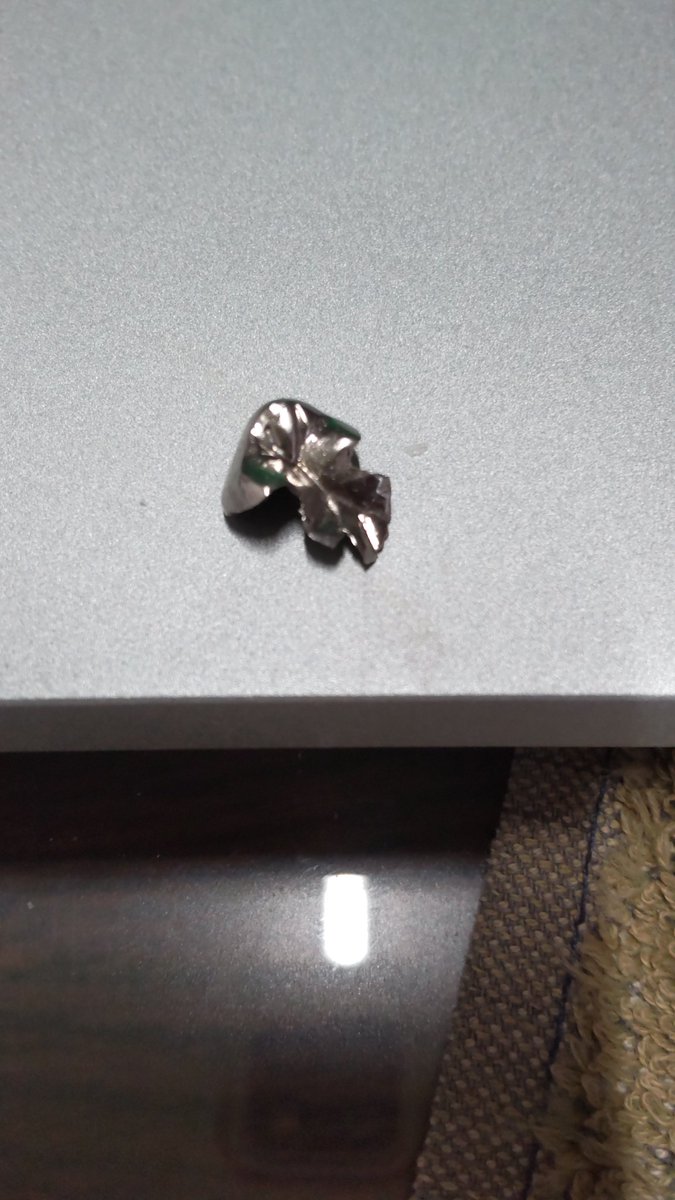 suki_aiko's tweet photo. ガムを噛むと脳の血流が増えて頭がさえるらしいと言う情報で、ここのところ噛んでました。
でも
治してあった銀が取れてしまいました。(>_<)
今日は歯医者さん休みだし
明日までの我慢です。 https://t.co/pCaQ7c53SP