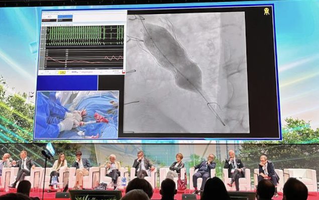🔥Morning Live cases #GISE44 <a href="/sicigise/">Sici GISE</a> 

📌TAVR in Type 0 bicuspid valve with BEV from Milan
📌TAVR in previous SAVR with SEV from Rome 

🔎Importance of pre procedural planning and device selection to optimize results 
Lot of discussion with a great panel