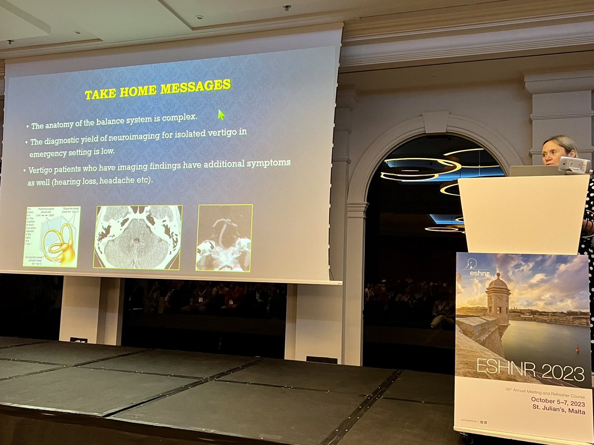 Great talk in the #ESHNR23 temporal bone session on imaging vertigo by @kovacsovics_bea 👏👏👏