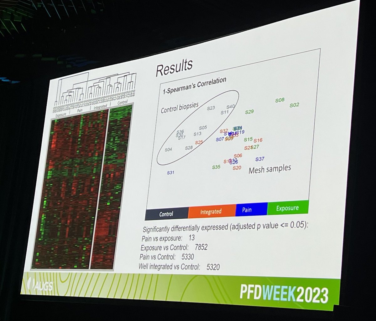 Marianna Alperin, MD/MS (@mariannaalperin) on Twitter photo Kudos to <a href="/AmandaArtsen/">Amanda Artsen MD</a> for winning the Best Basic Science paper for the deep dive analyses of graft-related complications <a href="/pamela_moalli/">Pamela Moalli</a> <a href="/urogynsociety/">AUGS</a> #PFDWeek23 Kudos to <a href="/AmandaArtsen/">Amanda Artsen MD</a> for winning the Best Basic Science paper for the deep dive analyses of graft-related complications <a href="/pamela_moalli/">Pamela Moalli</a> <a href="/urogynsociety/">AUGS</a> #PFDWeek23