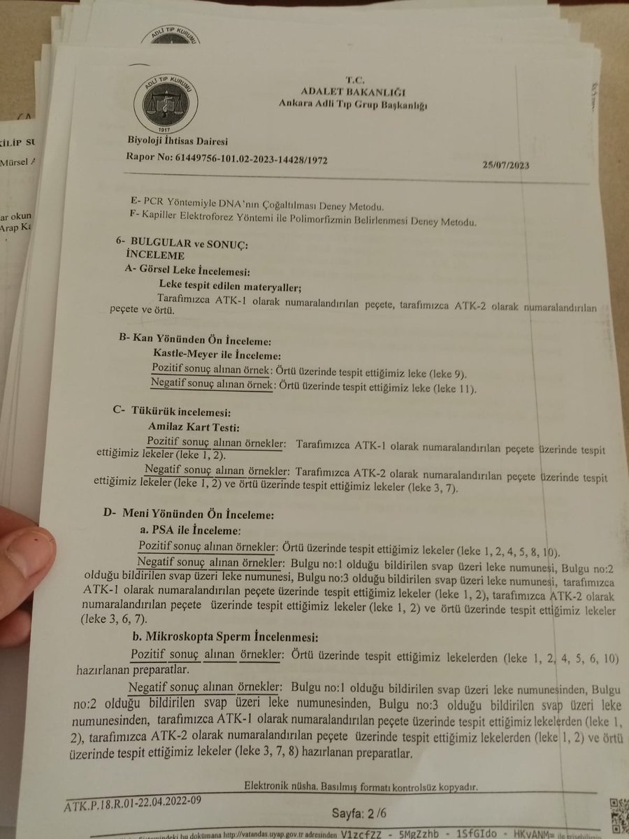 📍Erkek arkadaşı ve onun 3 arkadaşı tarafından zorla uyuşturucu maddeye maruz bırakıldı, tecavüze uğradı.

Çorum'da ayrılmak istediği erkek arkadaşı A.K. tarafından İskilip'te bulunan bir bağ evine çağrıldı. Başta gitmek istemesede, erkek arkadaşının ısrarına dayanamayarak gitti.