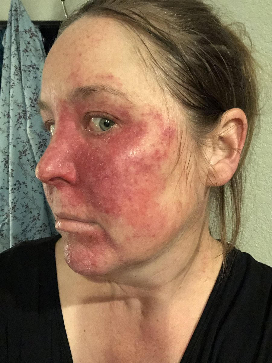 This Metastatic Life tweet media