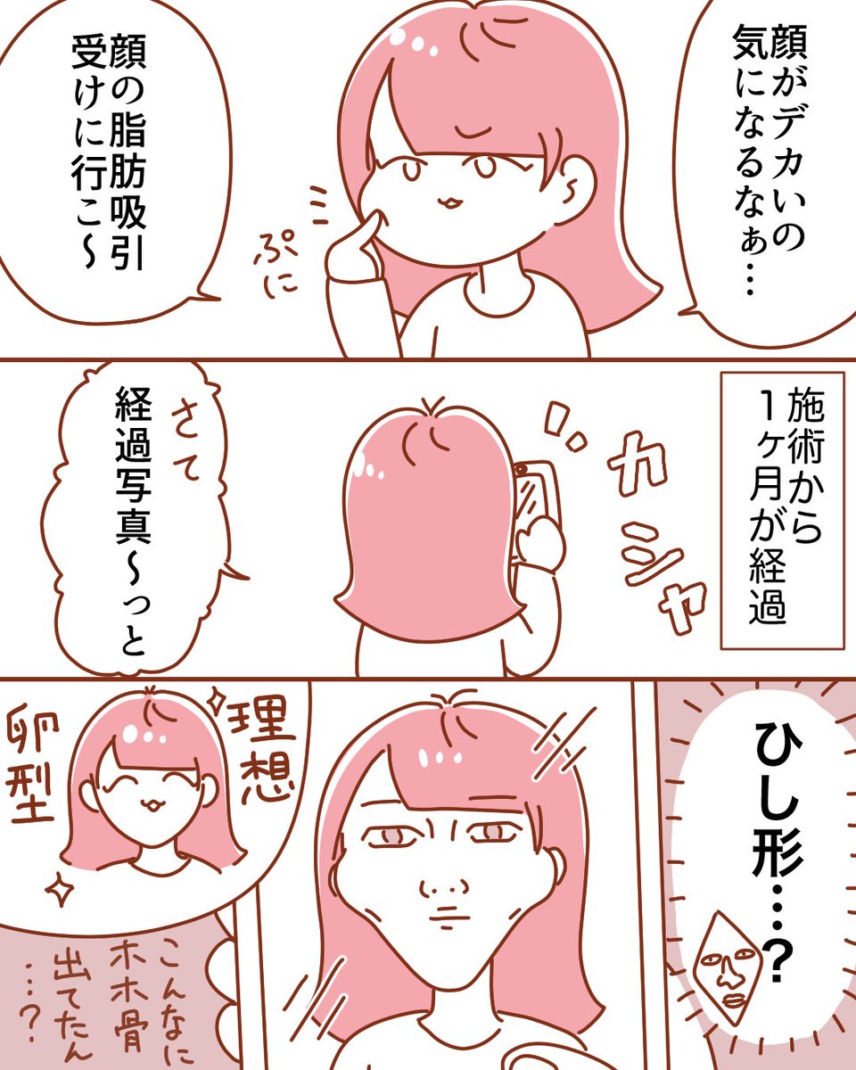 自分の輪郭も把握せずに顔の脂肪吸引した結果ホラーマンになりました😇
#整形垢 #渡韓 #エッセイ漫画 #漫画が読めるハッシュタグ