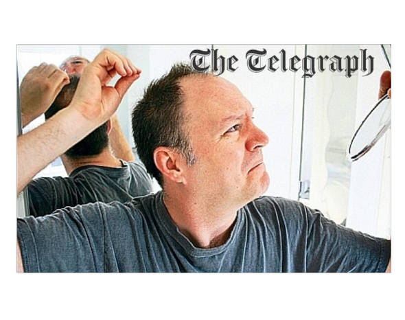 DavidSatchell's tweet photo. Suffering from #HairLoss or #Alopecia and not sure who to contact? Telegraph Life Coach says: one of the best #HairLoss clinics is Eucaderm - https://t.co/7ekEiTwc9T   https://t.co/PM4QyOd2ng https://t.co/iYZjI8reJC