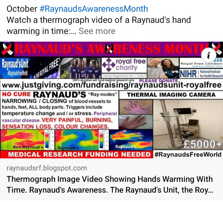 cosmicfairy444's tweet photo. October #RaynaudsAwarenessMonth thermograph video of a Raynaud's hand: https://t.co/50GegMhGp3 
Raynaud's Unit @RoyalFreeNHS
https://t.co/izvKtMIEhJ 
#RaynaudsFreeWorld #Research #Raynauds #BlueFingers #DigitalUlcers #Gangrene #Amputation  #VascularNeuropathy  #RaynaudsAwareness https://t.co/aS2dV3g2x0