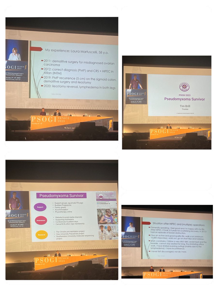 Rogini Balachandran (@ginibala) on Twitter photo What a great session at #PSOGI2023 inviting patients to give us their experience as being a cancer survivor. Their inputs are vital for us surgeons! <a href="/PMPSurvivor/">Pseudomyxoma Survivor</a> What a great session at #PSOGI2023 inviting patients to give us their experience as being a cancer survivor. Their inputs are vital for us surgeons! <a href="/PMPSurvivor/">Pseudomyxoma Survivor</a>