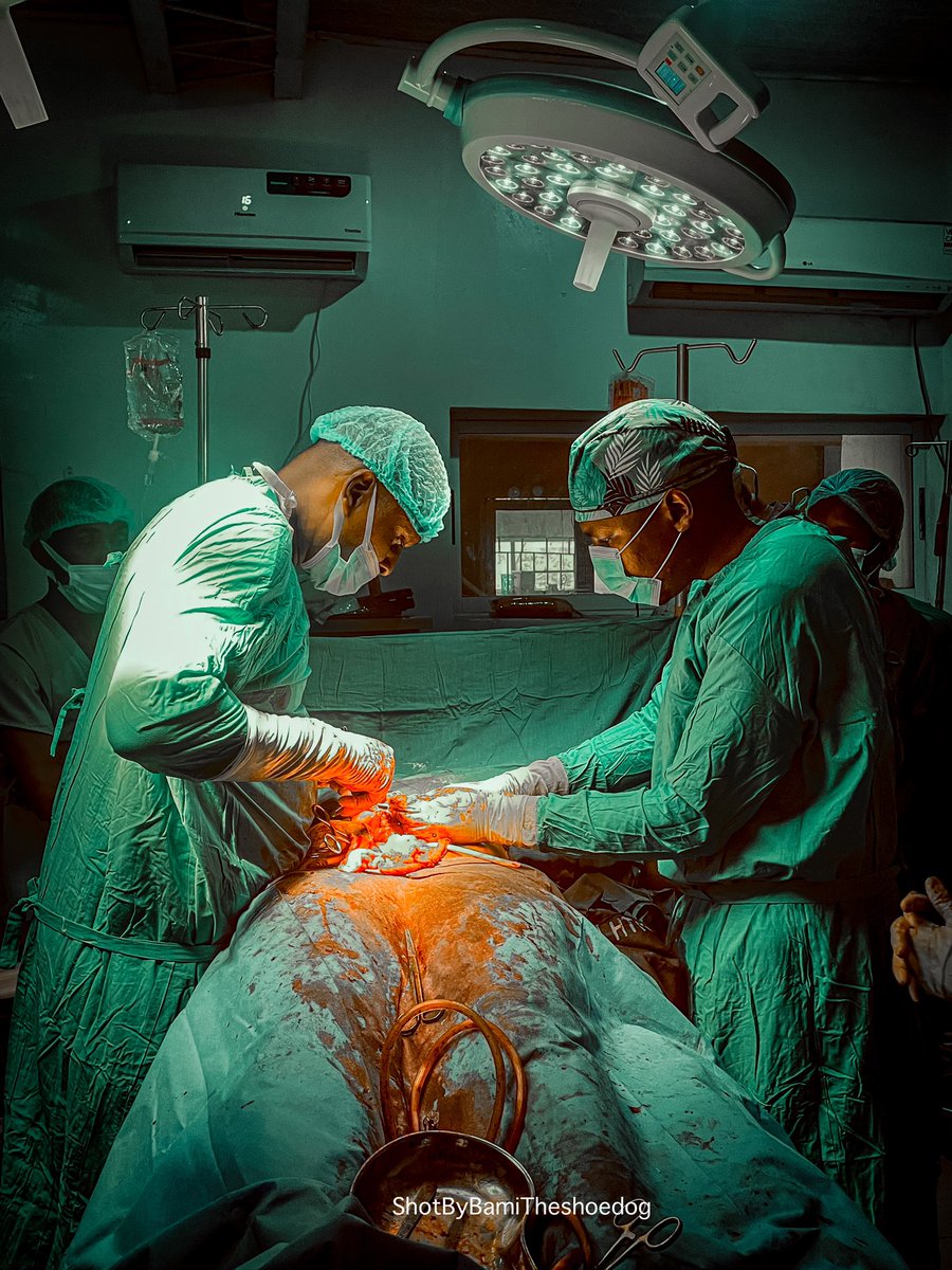 Doctor_Kachi's tweet photo. SurgeryDay!

Multiple myomectomy  

#LifeOfAMedstudent❗️
#Documentary 
#ShotbYyourstruly. https://t.co/xQU3QTbi6T