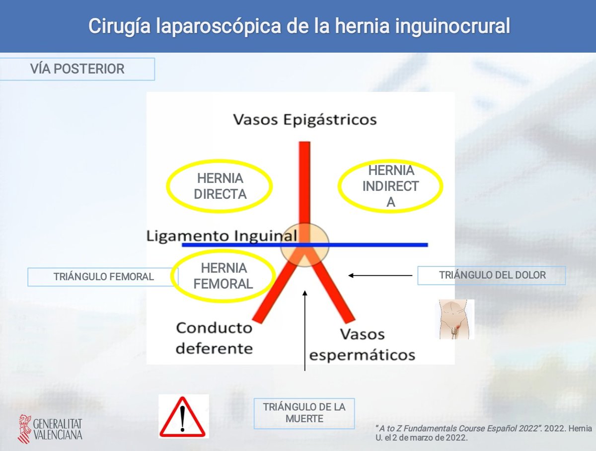 Provi Gª Pastor (@pastorprovi) on Twitter photo En el <a href="/HospitalLaFe/">HospitalLaFe</a>
seguimos con las actividades del curso de cirugía endoscópica para residentes R5 de la AEC. Hoy cirugía en directo. TEP vs TAPP.
Muchas gracias a la colaboración de excelentes cirujanos
<a href="/jdcarrera68/">JOSE CARRERA</a> <a href="/pepenoguera3/">pepenoguera</a> <a href="/InesAldrey/">Inés</a>
Hasta la próxima !! 👍 En el <a href="/HospitalLaFe/">HospitalLaFe</a>
seguimos con las actividades del curso de cirugía endoscópica para residentes R5 de la AEC. Hoy cirugía en directo. TEP vs TAPP.
Muchas gracias a la colaboración de excelentes cirujanos
<a href="/jdcarrera68/">JOSE CARRERA</a> <a href="/pepenoguera3/">pepenoguera</a> <a href="/InesAldrey/">Inés</a>
Hasta la próxima !! 👍