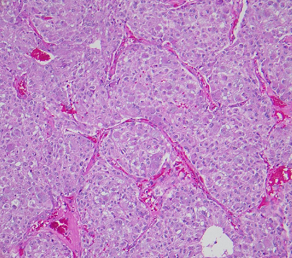 megothelioma's tweet image. How would you describe this architectural pattern, #pathresidents?

#PathTwitter